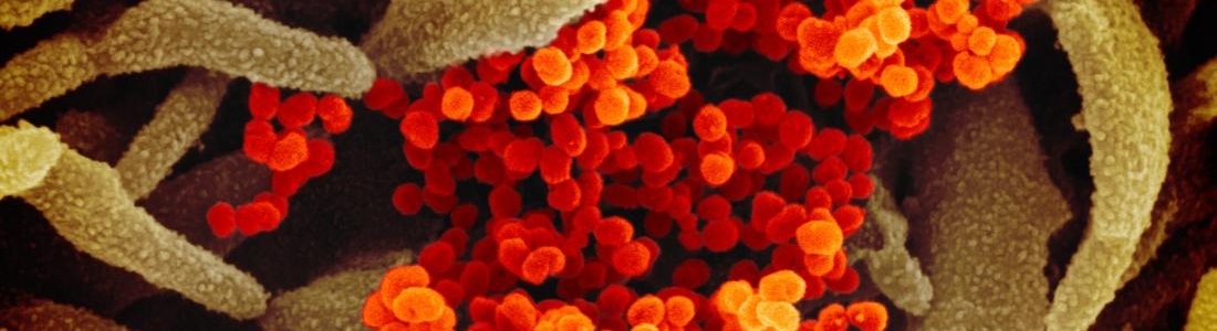 Coronavirus news and live updates from around the world