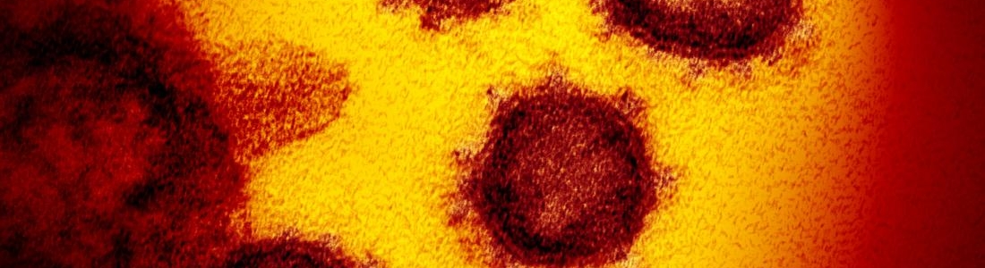 Why some people who haven’t had Covid-19 might already have some immunity